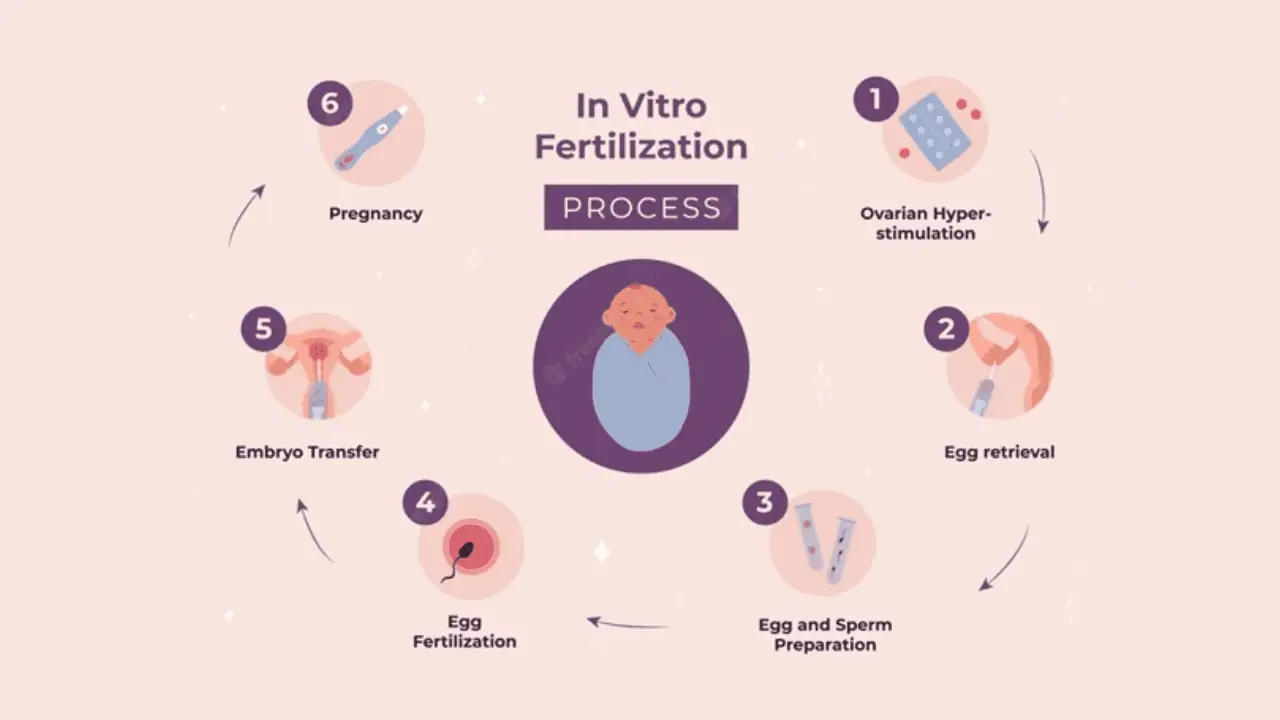 IVF Procedure