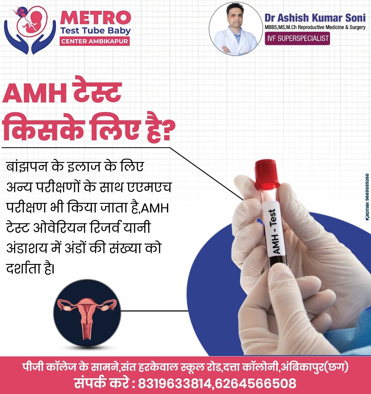 IVF Important Tips | Metro IVF Ambikapur